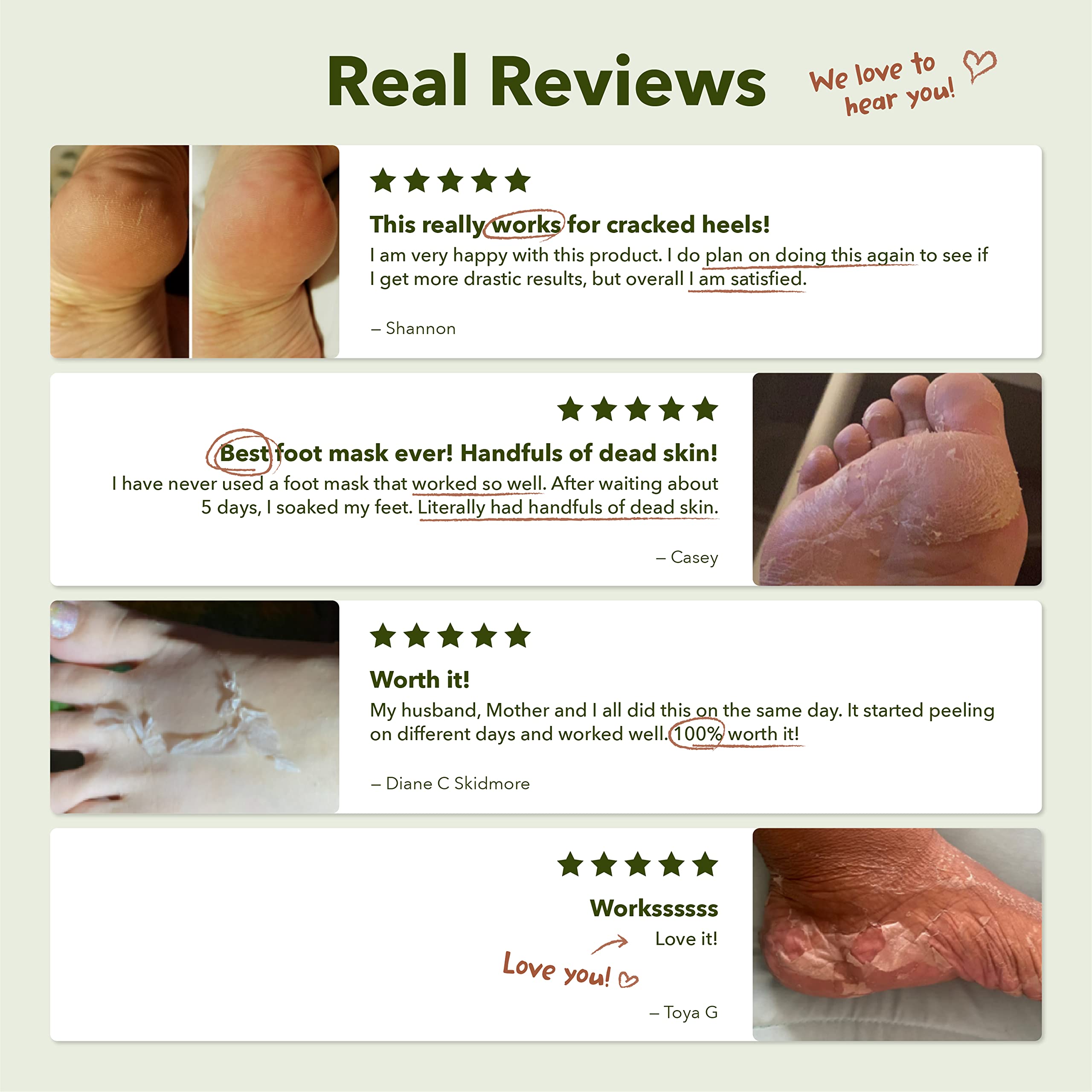 Purederm lifestyle shot beach-ready feet conveying confidence and smoothness