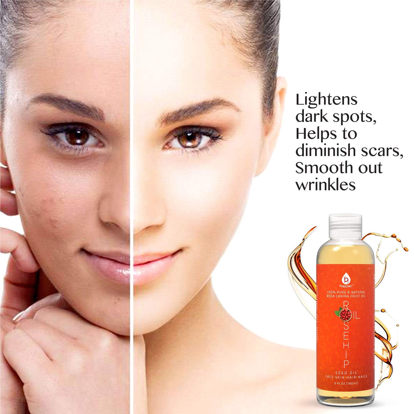 PURSONIC massaged into cuticles illustrating conditioning and nail care
