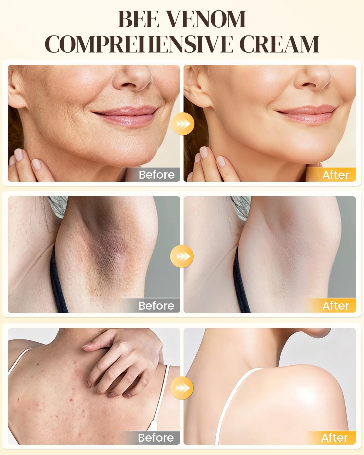 QISARONIX applying cream to neck and décolleté for even hydration and refined texture benefit