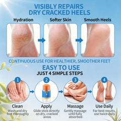 QKCXHB stick being applied to a cracked heel for direct treatment