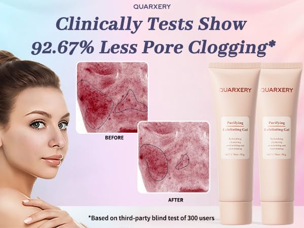 QUARXERY used on shoulder to clear body pores and smooth skin