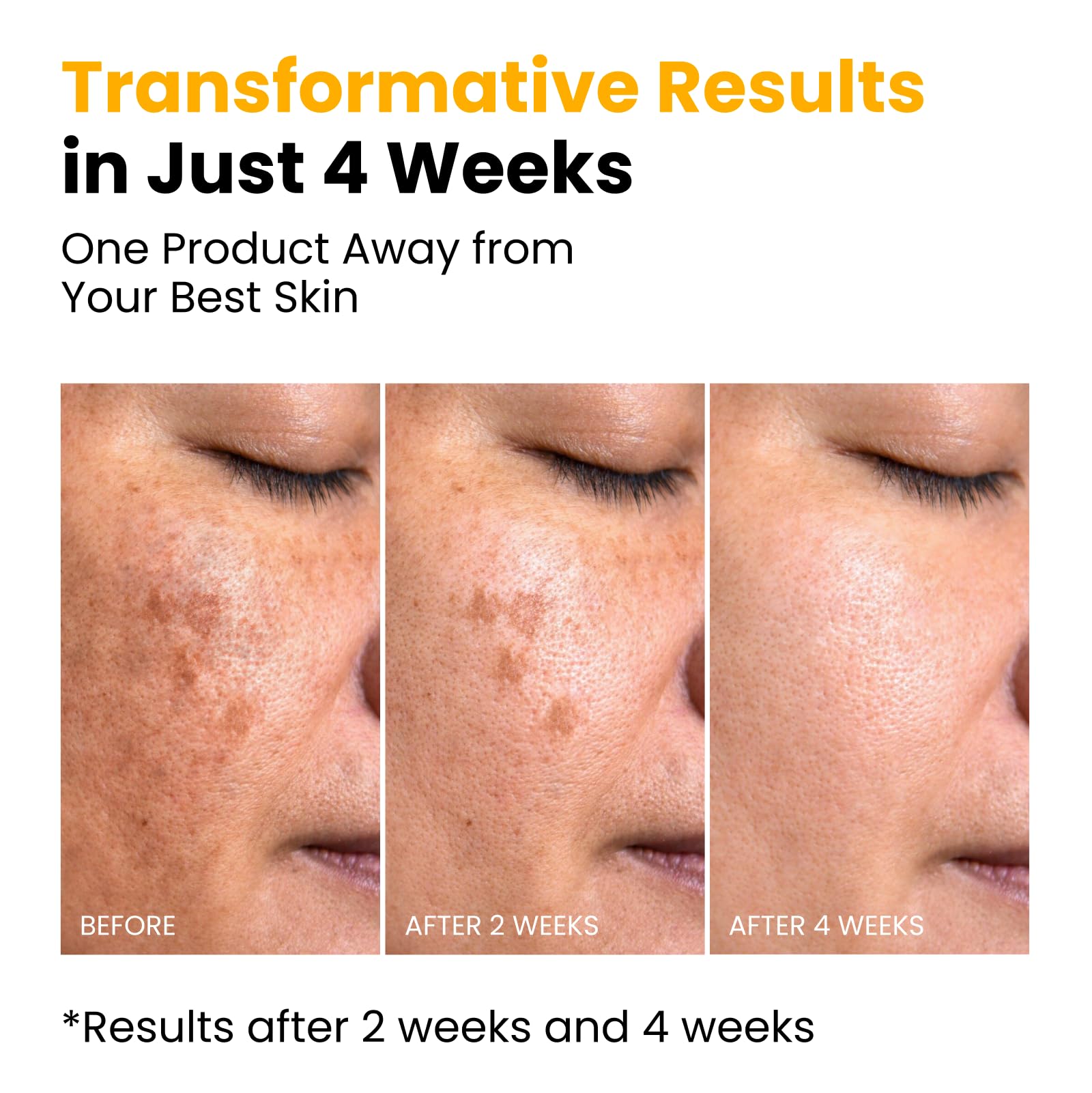 QUIA Beauty before and after comparison illustrating improved texture