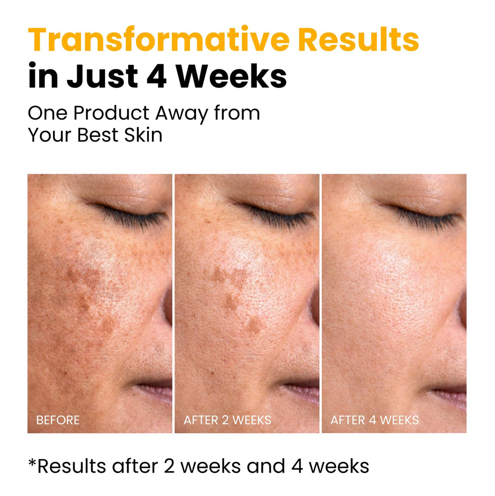 QUIA Beauty before and after comparison illustrating improved texture