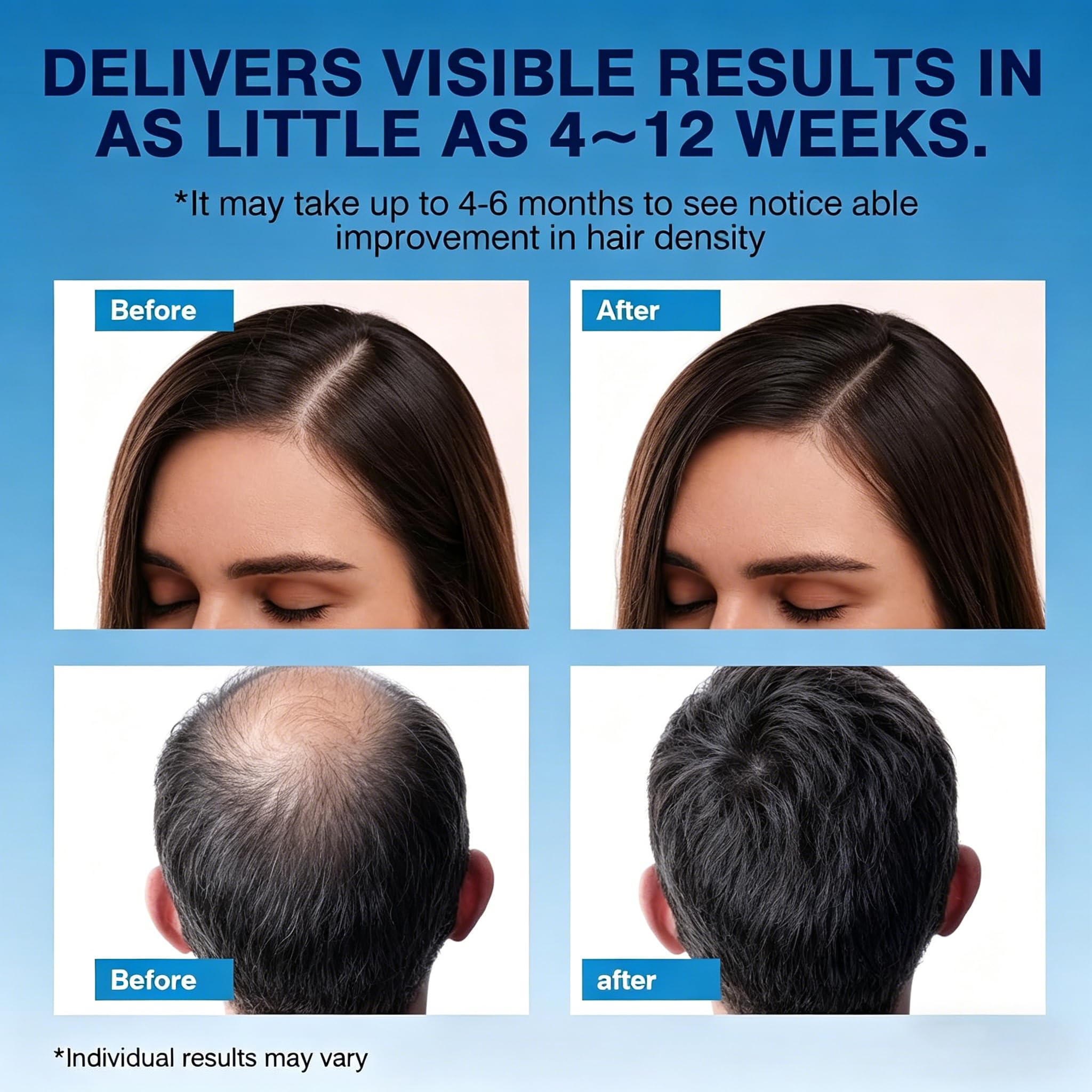 Quilom foam applied to thinning scalp showing targeted coverage and non-greasy finish