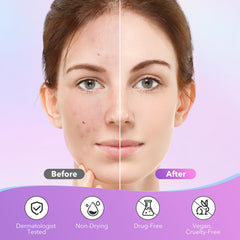 QUSTERE patch applied on cheek demonstrating protective coverage and discreet look