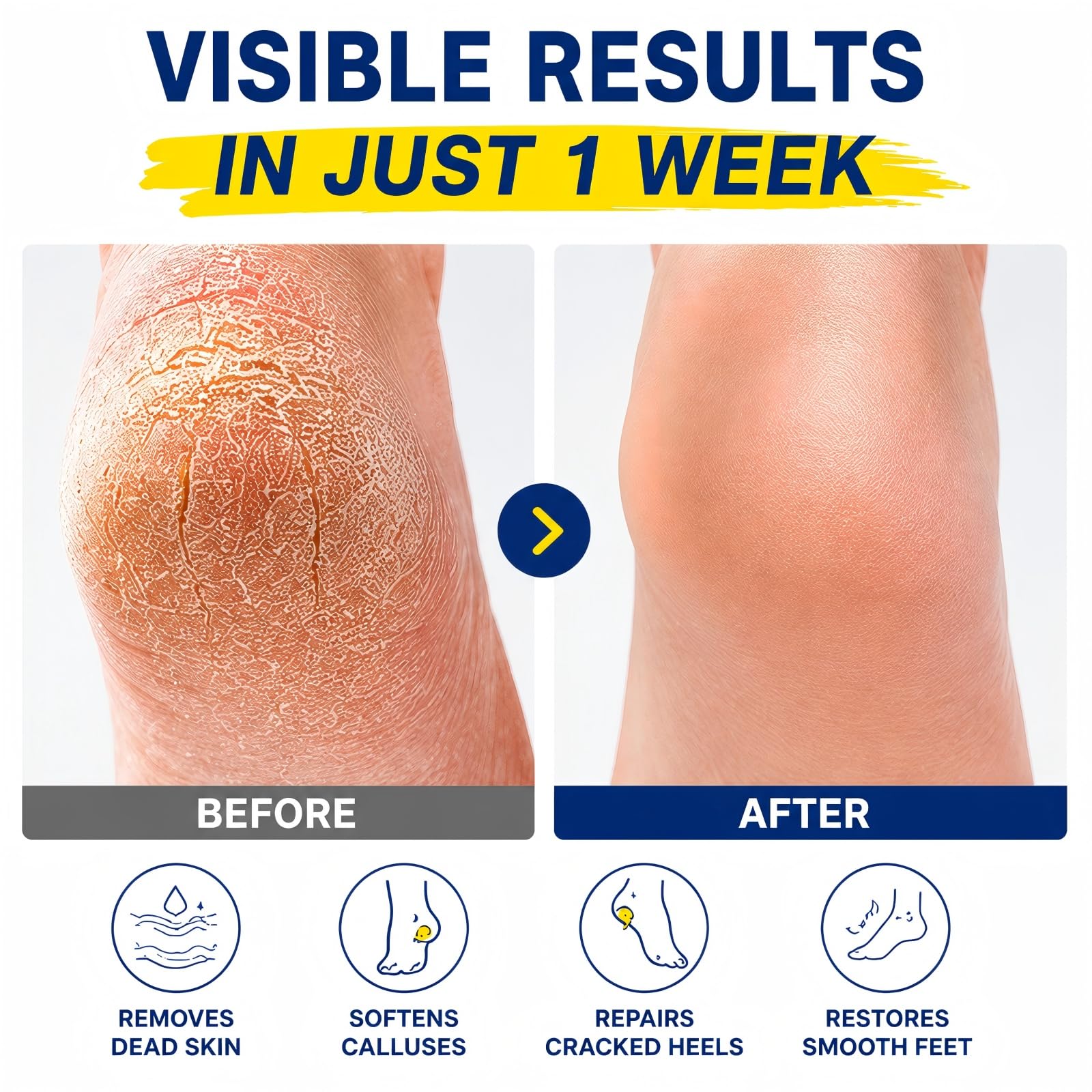 QVCQ label close-up highlighting 60% urea and 2% salicylic acid concentrations