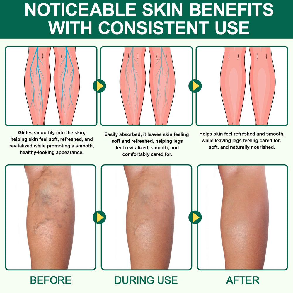 QYQIZWIA being applied to legs to soothe and relieve tiredness