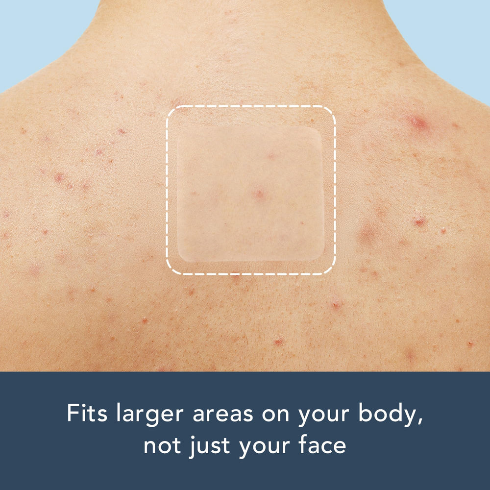 Rael hydrocolloid texture close-up highlighting absorbency