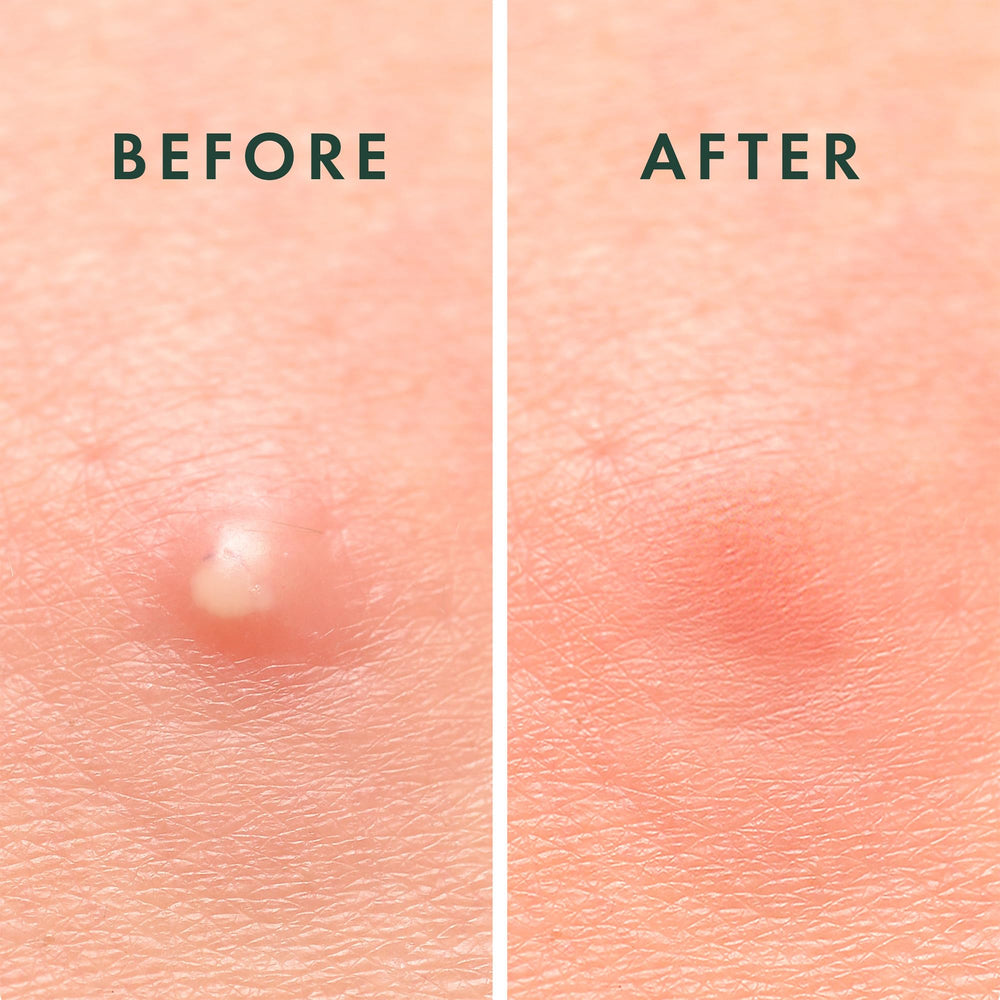 Rael patch on cheek overnight showing secure adhesion and protection