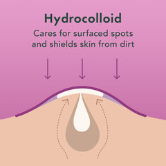Rael patch applied on cheek showing comfortable coverage