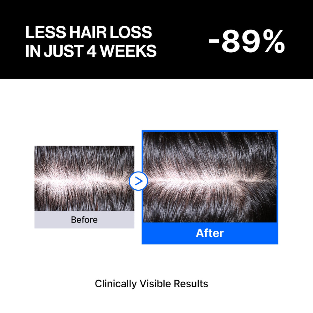Refilled applicator close-up demonstrating precise scalp delivery