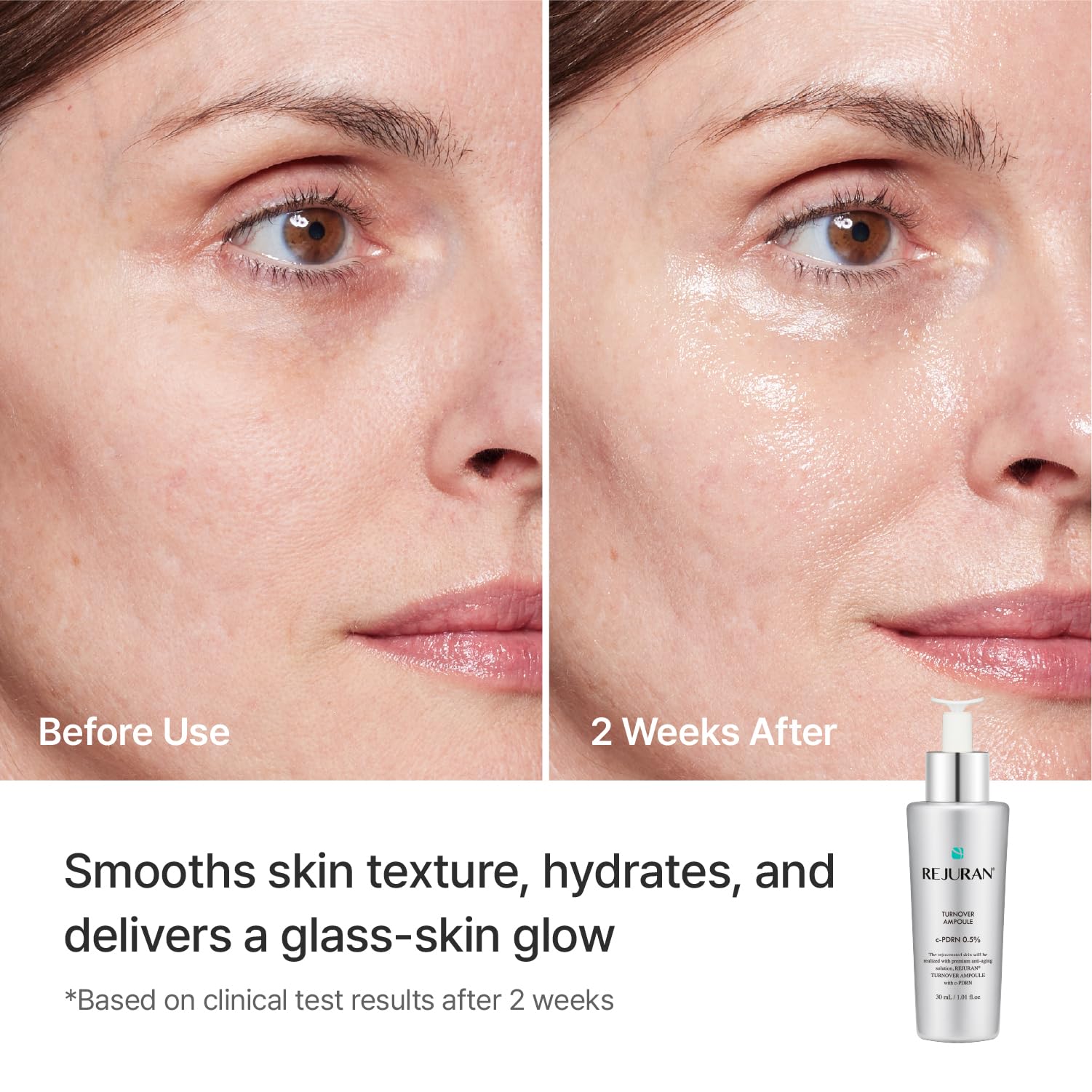 REJURAN ampoule held in hand to show true size and travel-friendly benefit