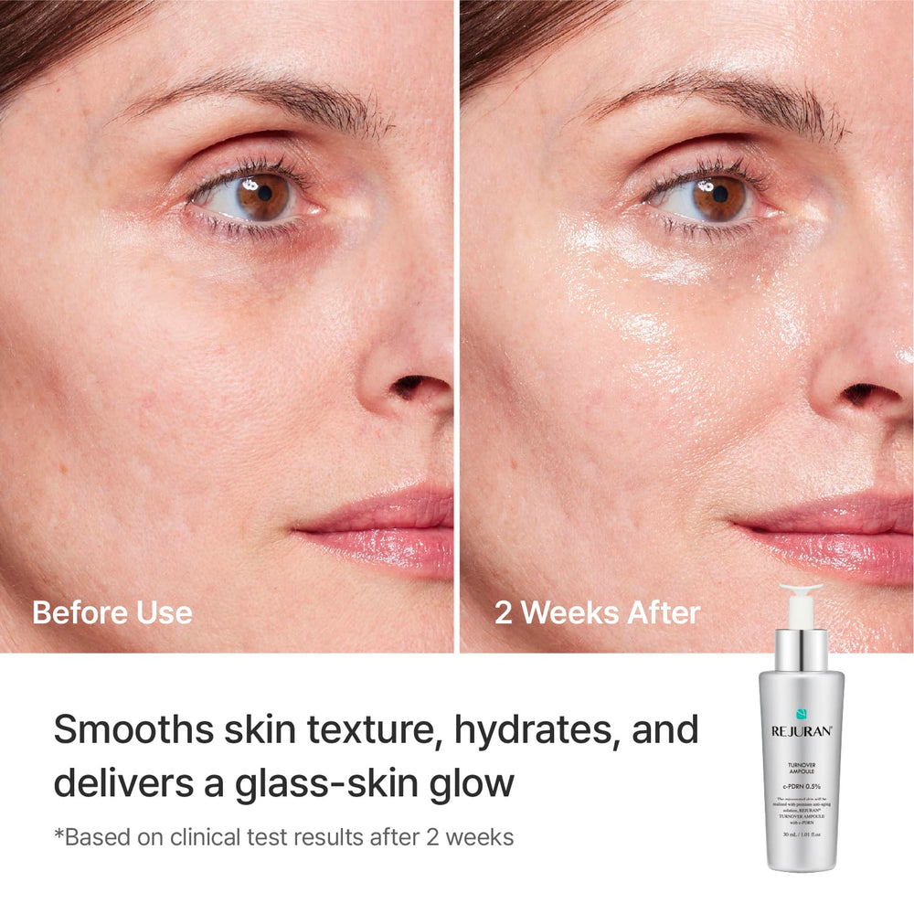 REJURAN ampoule held in hand to show true size and travel-friendly benefit