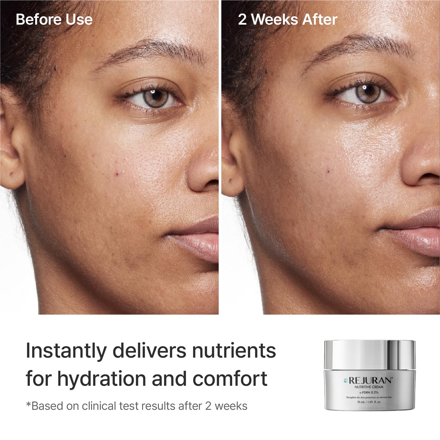 REJURAN cream on hand for scale, demonstrates coverage and absorption