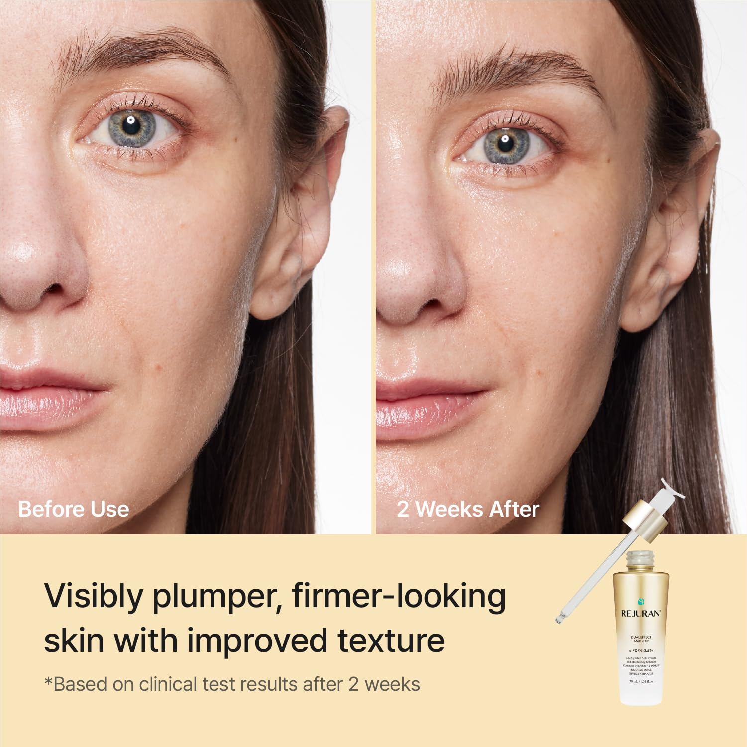 REJURAN ampoule held in hand to show 1.69 fl oz size and scale benefit