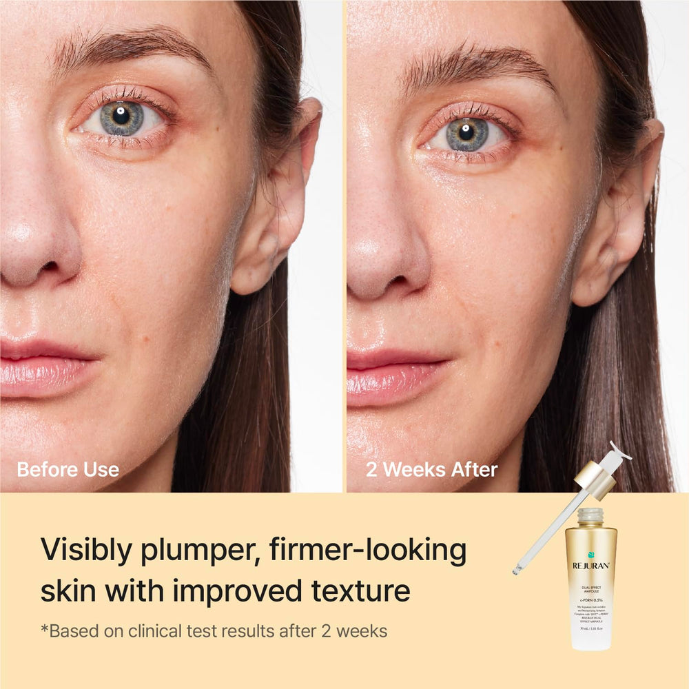 REJURAN ampoule held in hand to show 1.69 fl oz size and scale benefit
