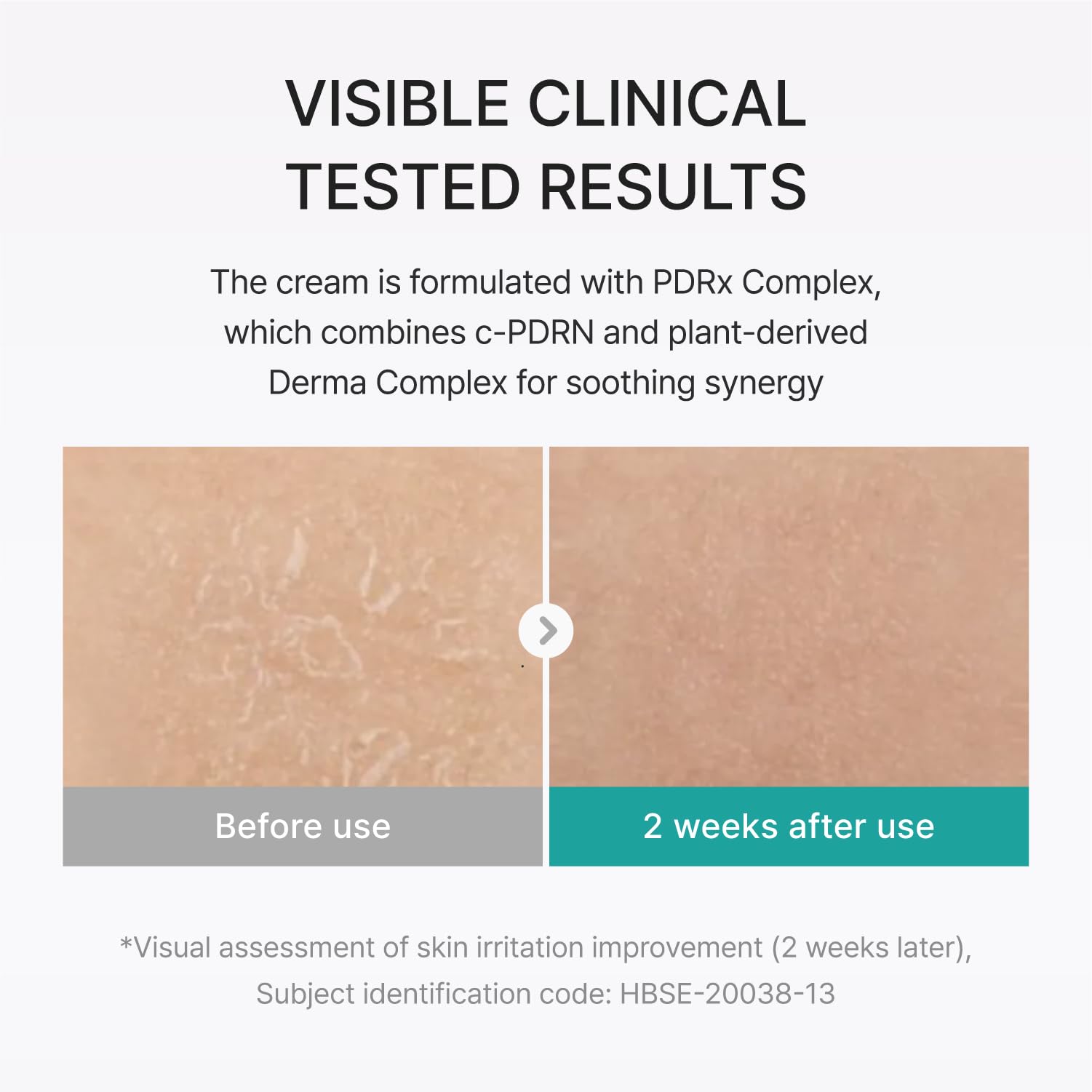 REJURAN ceramides ingredient close-up for visible barrier repair