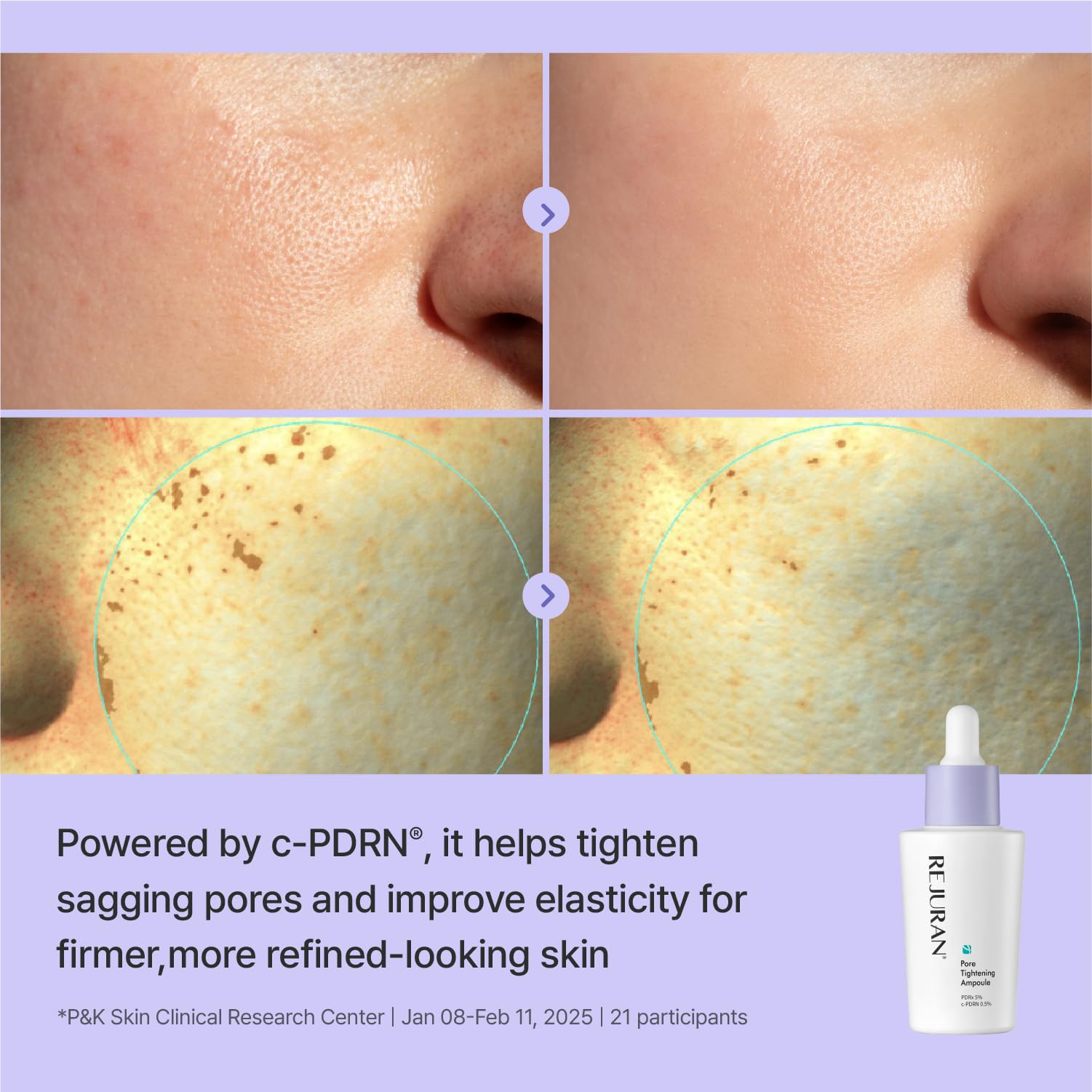 REJURAN product label highlighting PDRx 5% and c-PDRN 0.5% actives