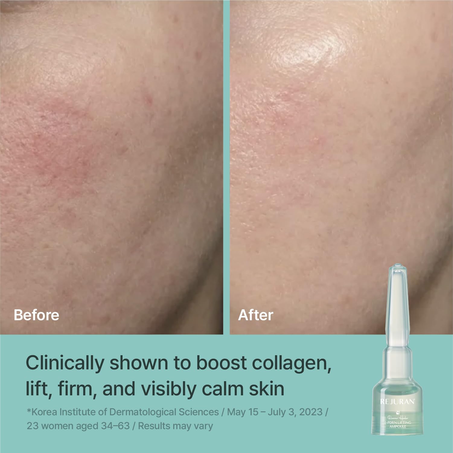 REJURAN serum texture on skin closeup showing fast absorption and hydrated finish