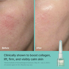 REJURAN serum texture on skin closeup showing fast absorption and hydrated finish