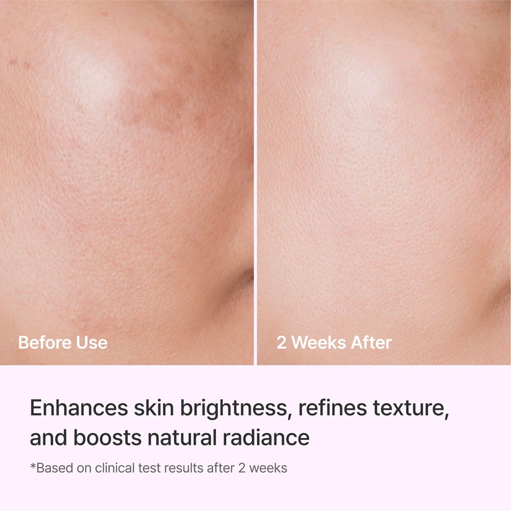 REJURAN ampoule held in hand to show 50ml scale and practical size