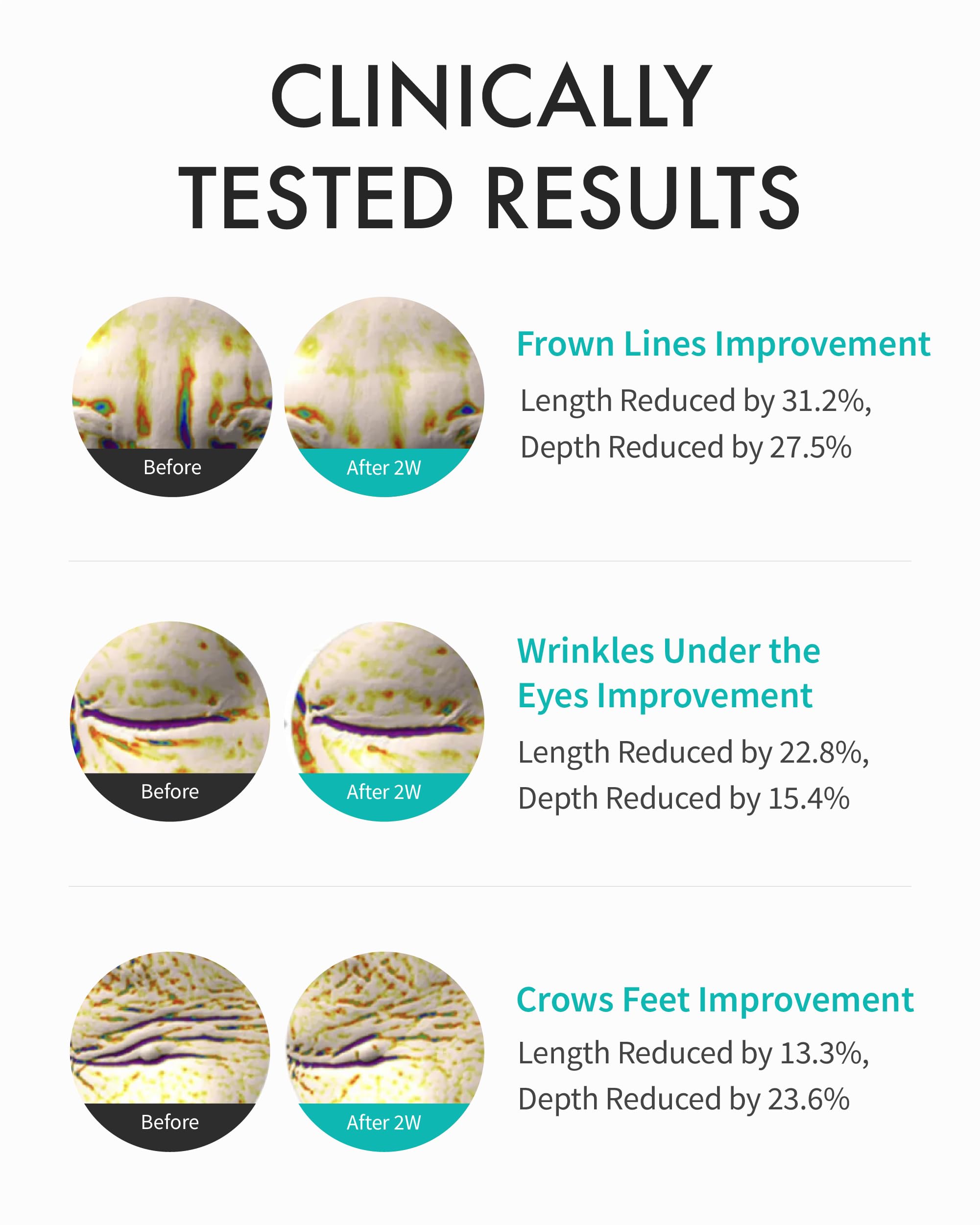 REJURAN ingredient visual c-PDRN emphasizing regenerative support