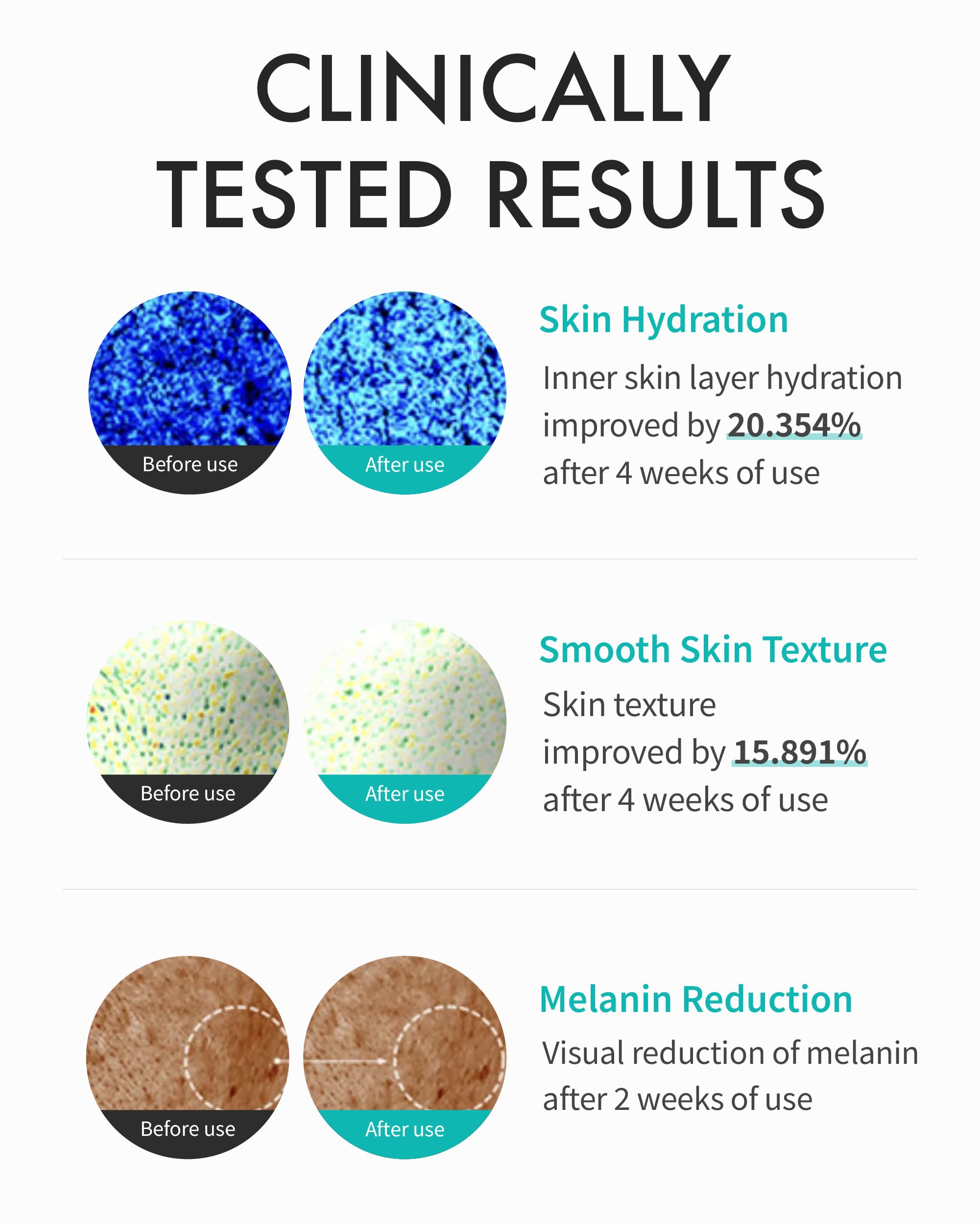 REJURAN application on hand illustrating lightweight spreadability and quick absorption