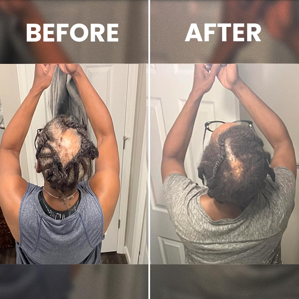 Rennora Beauty before and after styling showing improved hair strength benefit