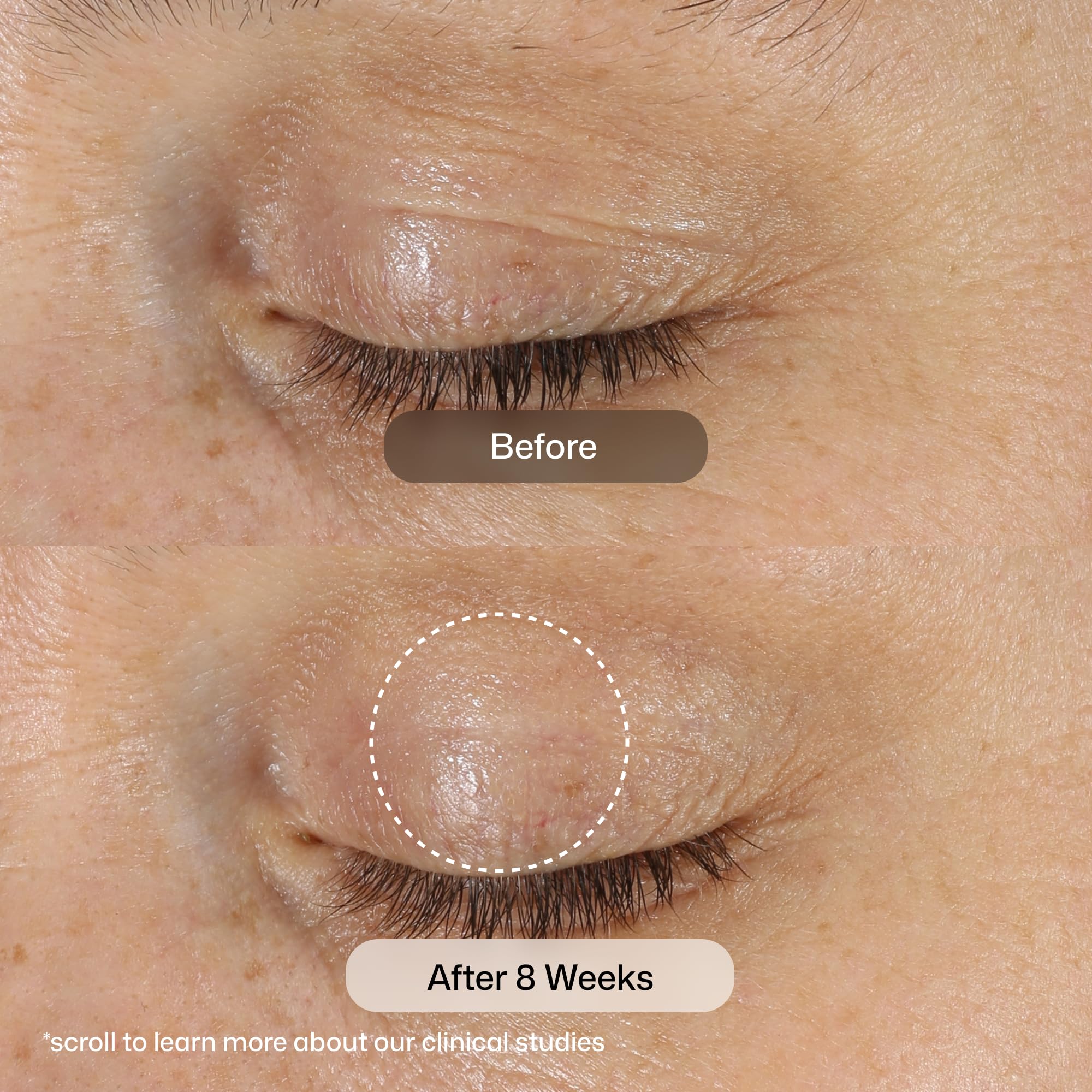 Revision Skincare applying eye cream to under-eye for firmer look