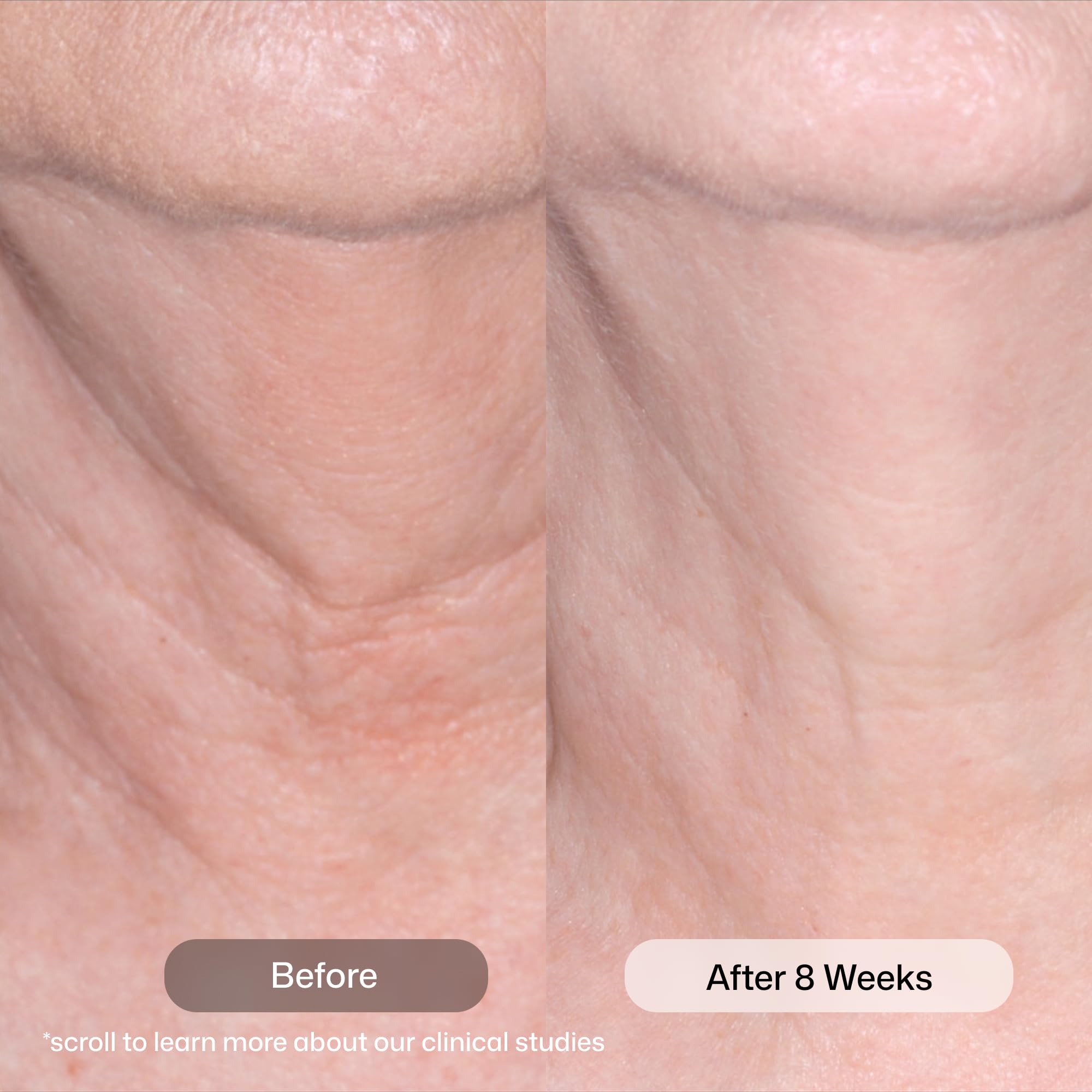 Revision Skincare creamy texture close-up demonstrating smooth spreadability