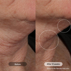 Revision Skincare peptide and plant extract blend close-up for skin support