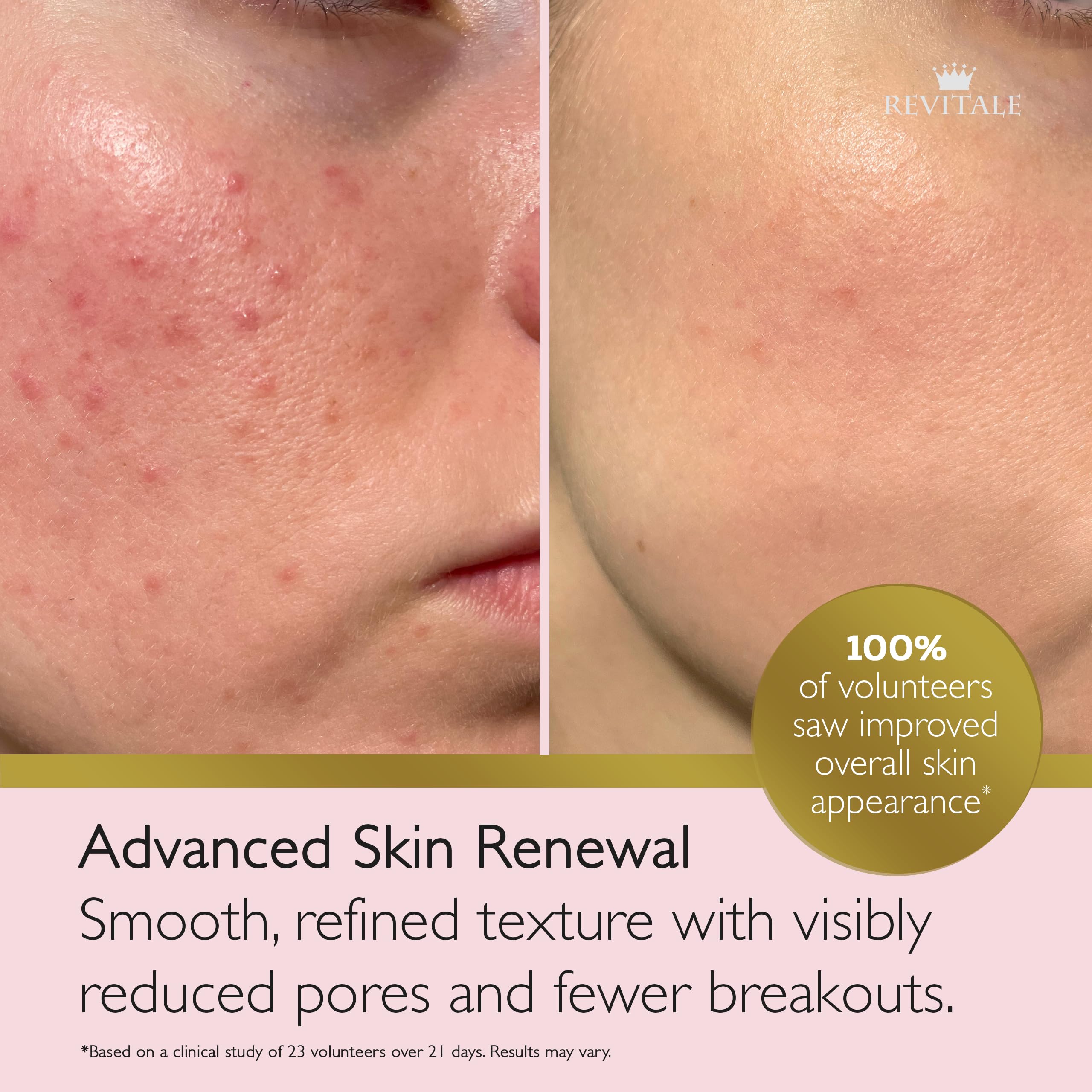 REVITALE cream texture close-up highlighting smooth consistency and quick absorption