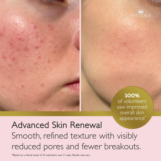 REVITALE cream texture close-up highlighting smooth consistency and quick absorption