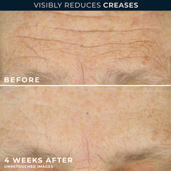 RoC capsule held in hand showing measured retinol dose for skin renewal