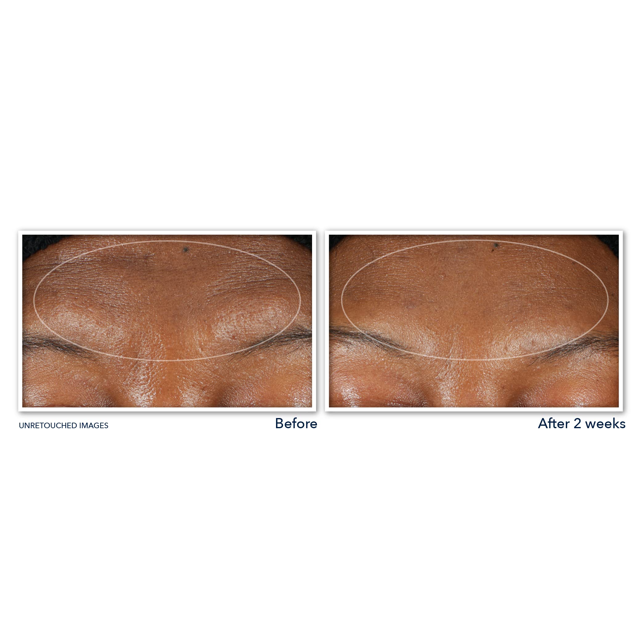 RoC lather removing mascara and foundation, illustrating effective makeup removal benefit