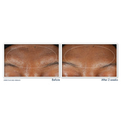 RoC lather removing mascara and foundation, illustrating effective makeup removal benefit