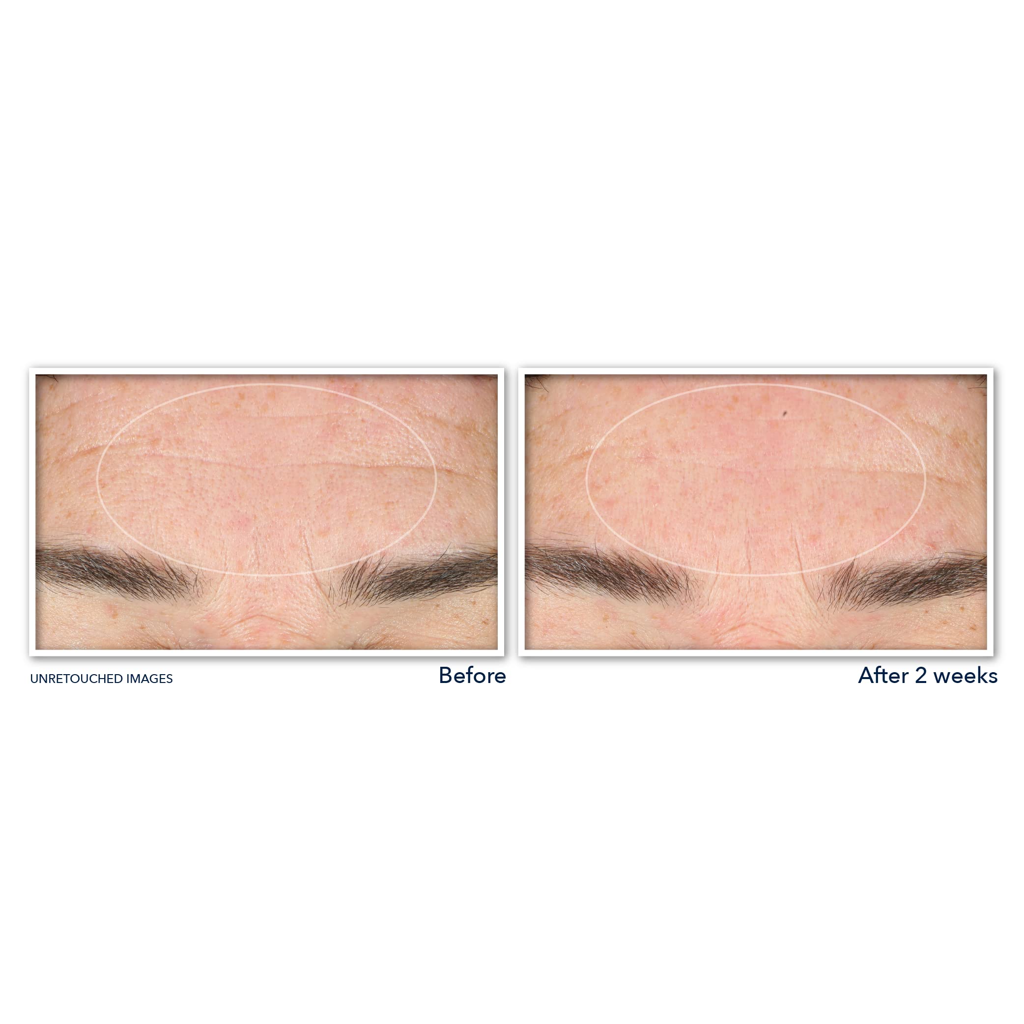 RoC close-up of label highlighting retinol and niacinamide, supporting smoother-looking skin