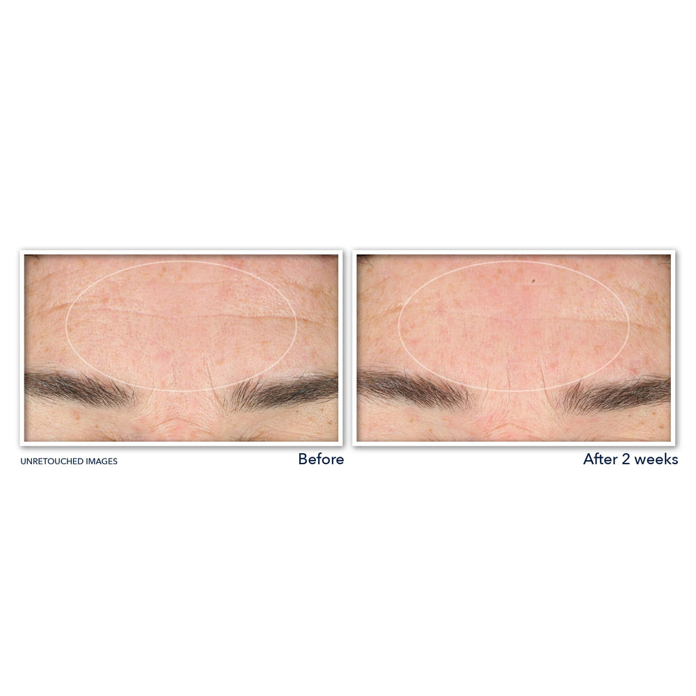 RoC close-up of label highlighting retinol and niacinamide, supporting smoother-looking skin