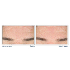 RoC close-up of label highlighting retinol and niacinamide, supporting smoother-looking skin