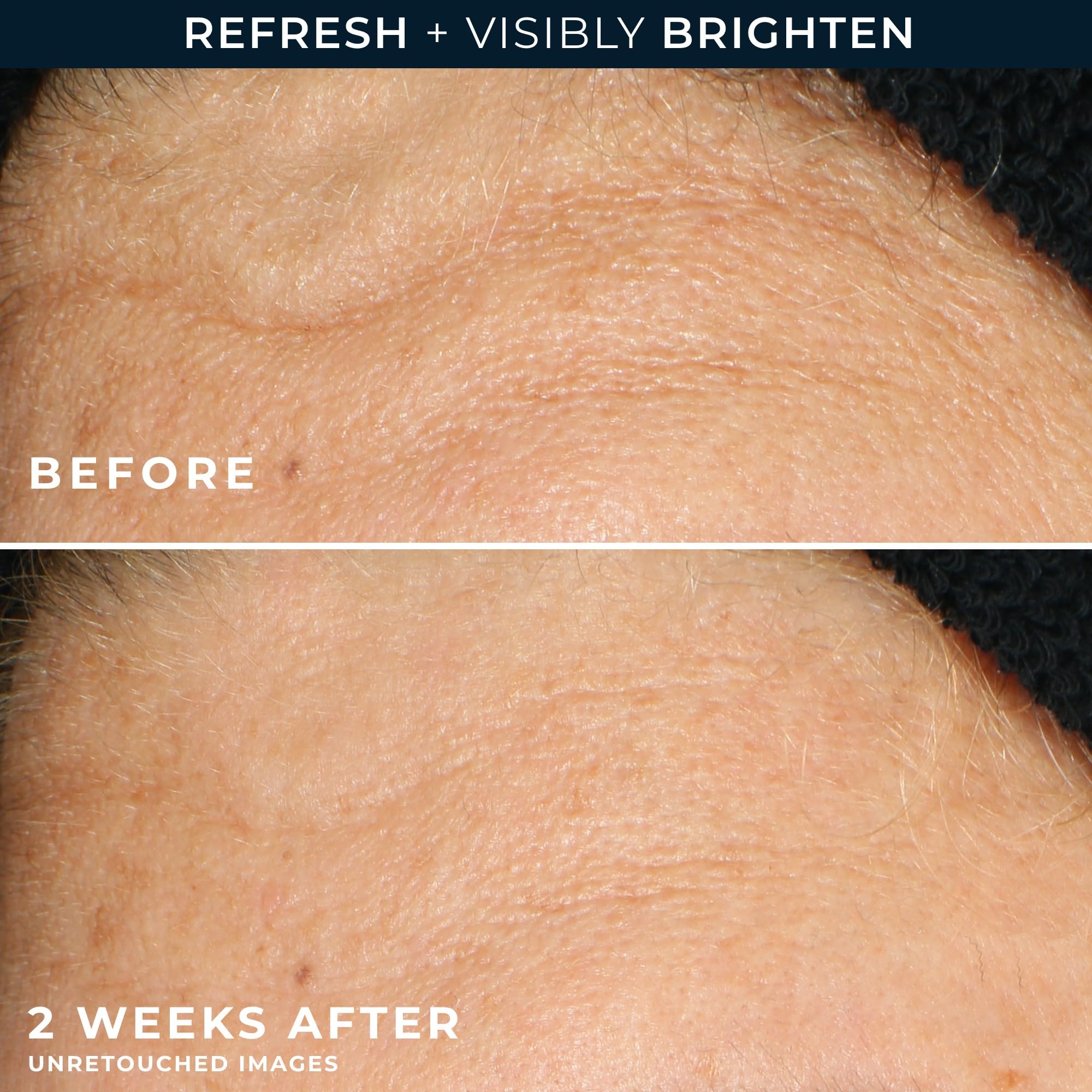 RoC label detail showing active glycolic acid and Vitamin C blend