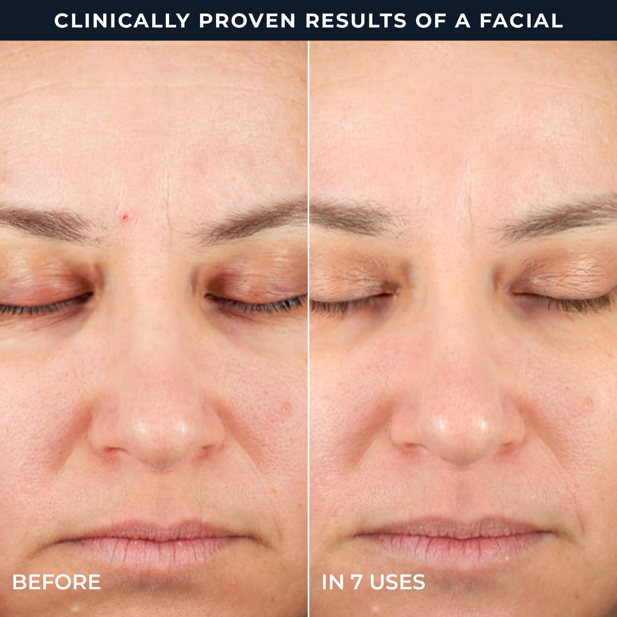 RoC Step 2 pad label showing patented clinical retinol and Ectoin