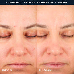 RoC Step 2 pad label showing patented clinical retinol and Ectoin