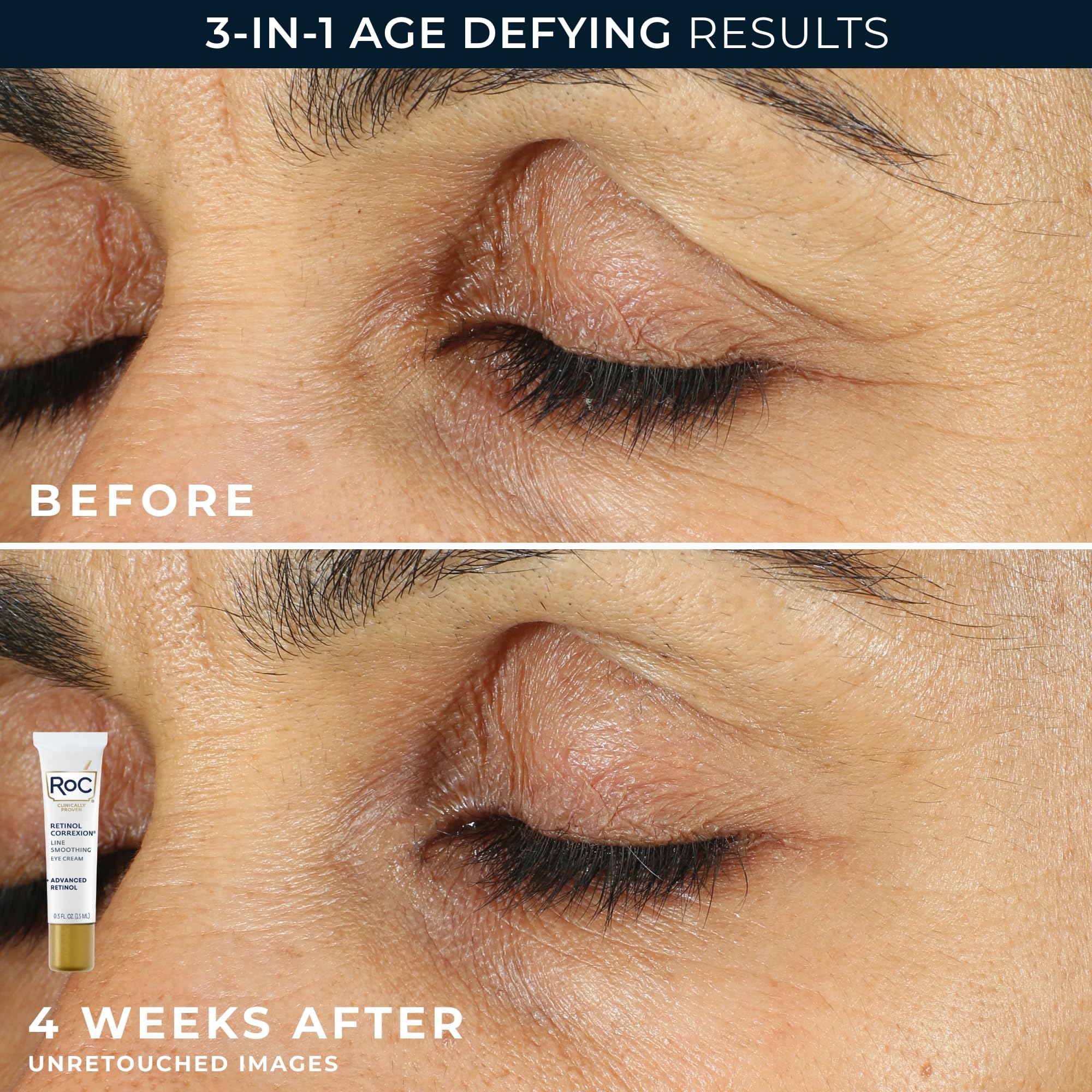Applying RoC night cream in evening routine for overnight wrinkle care benefit