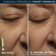 RoC eye cream applied beneath eye demonstrating reduced puffiness benefit