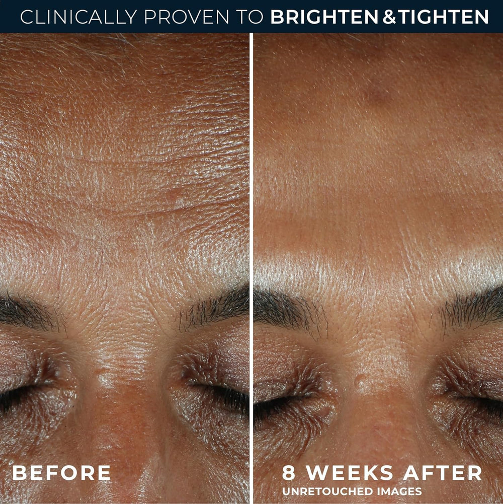 RoC close-up of the eye balm tip highlighting cooling glide and precision