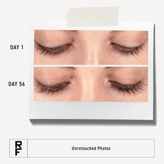 Rodan + Fields applicator close-up showing precise tip for easy nightly application