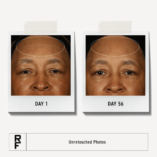 RODAN + FIELDS open cream texture close‑up highlighting rich moisturization