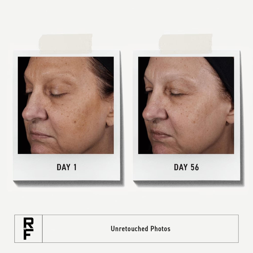 RODAN + FIELDS tube beside serum showing prepped skin absorbing treatments better
