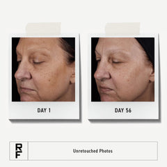 RODAN + FIELDS tube beside serum showing prepped skin absorbing treatments better
