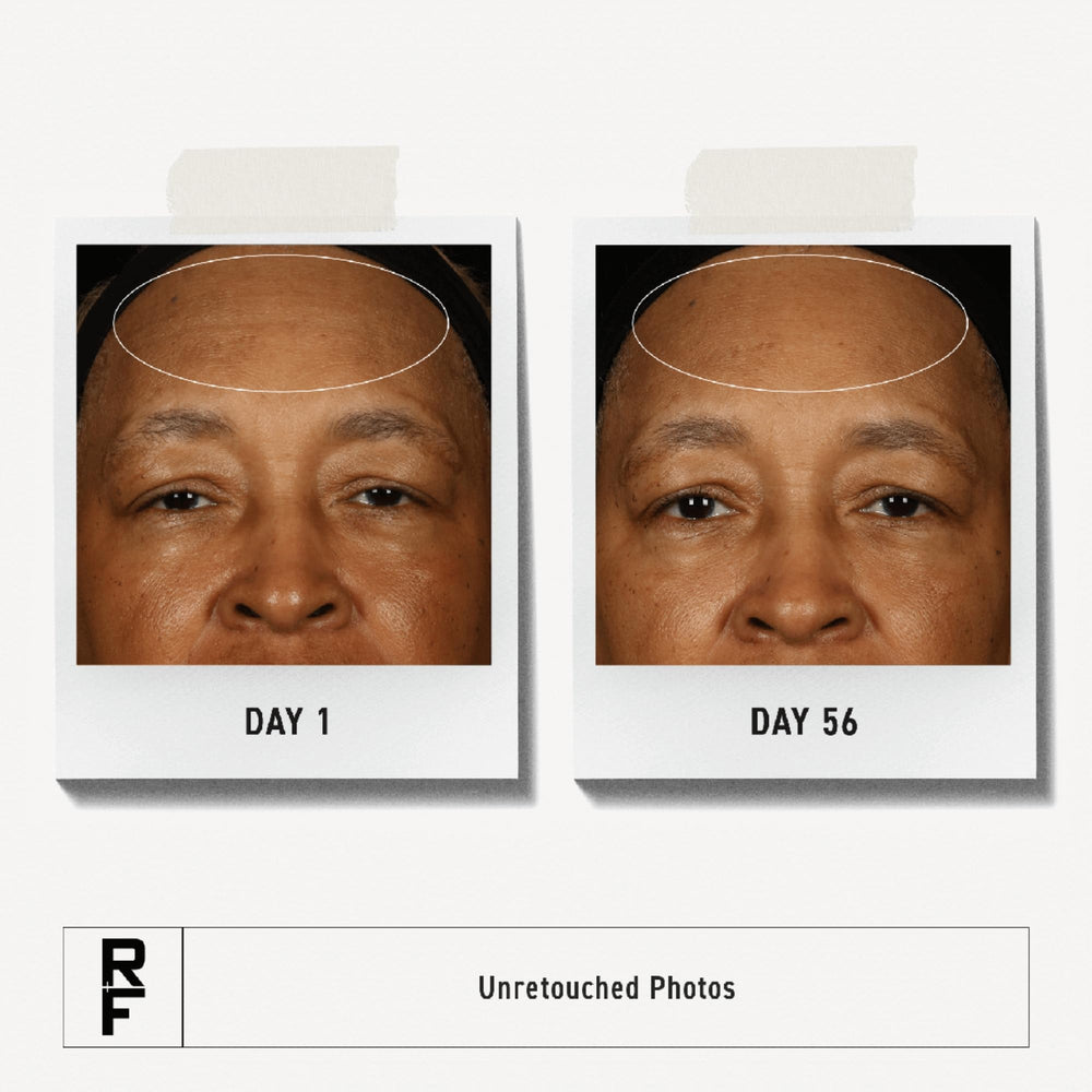 RODAN + FIELDS close-up of cream texture highlighting hydrating finish